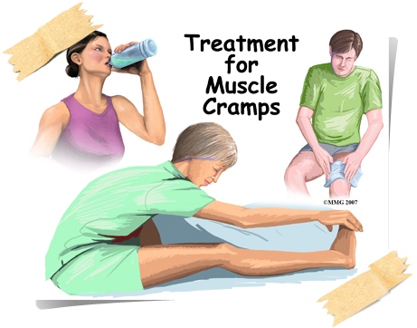 muscle cramps_treatment01